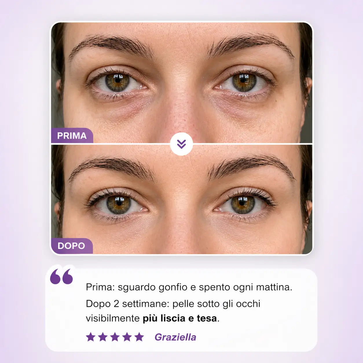 Crema Vibrante K-Beauty per Occhiaie, Borse e Rughe
