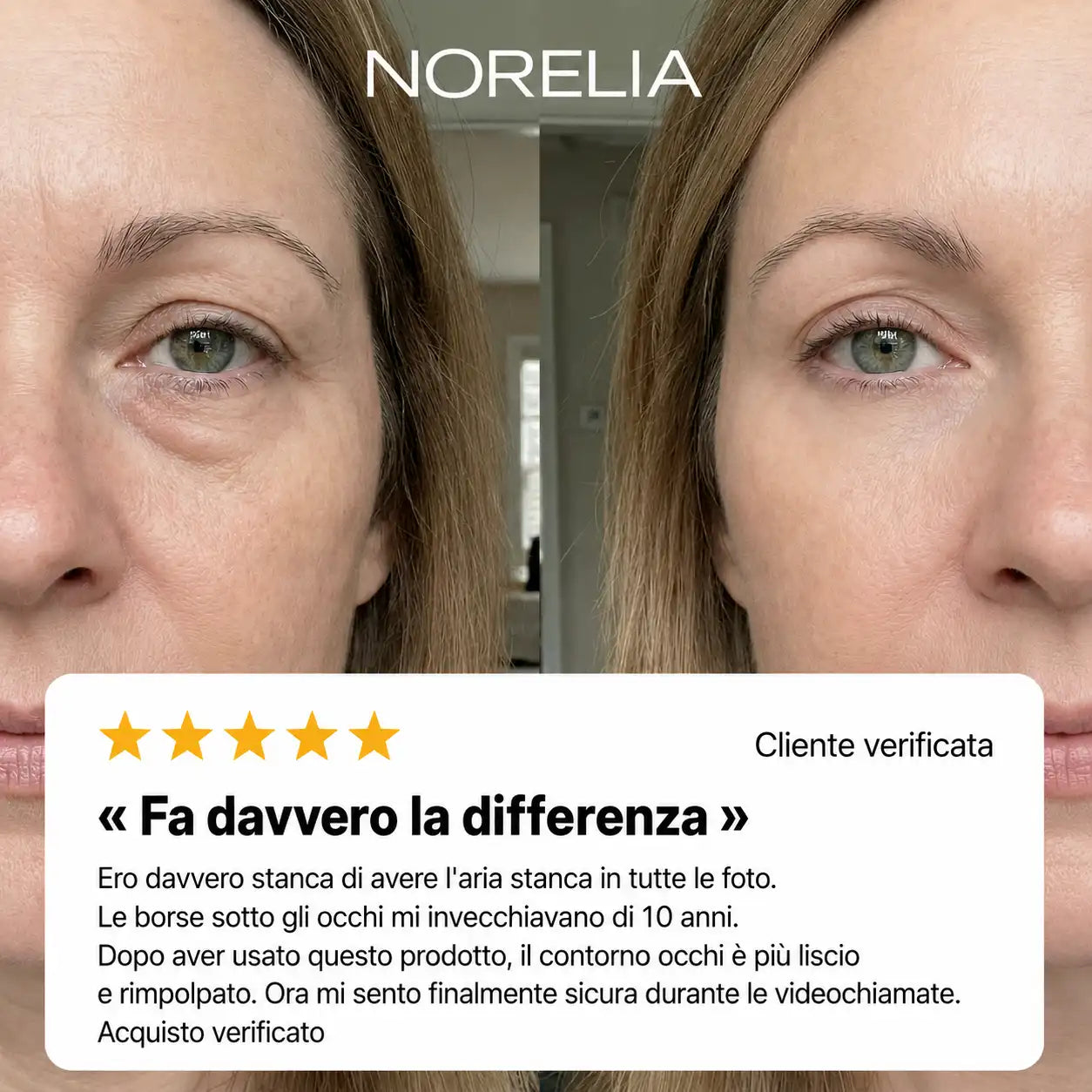 EyeTense™-  La crema che tende lo sguardo all'istante