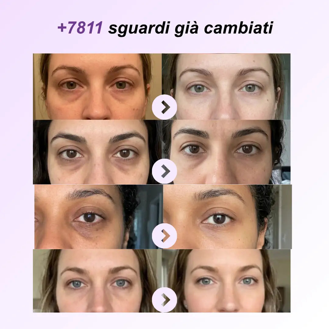 Crema Vibrante K-Beauty per Occhiaie, Borse e Rughe